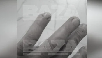 Мужчина откусил палец женщине в подмосковном кафе