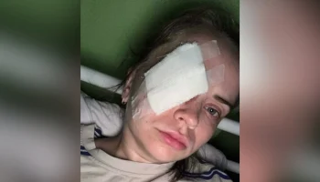 В Перми неизвестный выстрелил девушке в глаз из пневматики