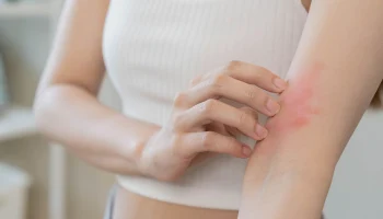 Аллергия на холод: почему возникает, кто в группе риска и способы профилактики