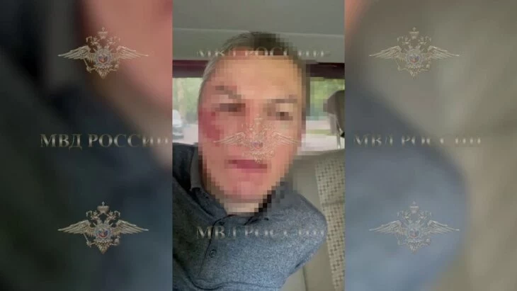 Задержан подозреваемый в нападении на ребенка в Люберцах Задержан подозреваемый в нападении на ребенка в Люберцах