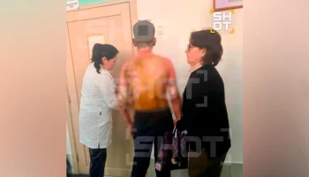 Трое детей попали в больницу с ожогами из школы в Красноярске