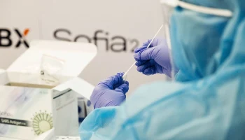 Оспа обезьян в Подмосковье? Что это за вирус, какие у него симптомы и чем опасен