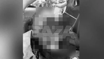 ТАСС: состояние ребенка, на которого напали собаки в Сочи, стабилизировалось