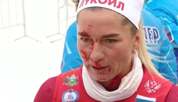 Лыжница Сорина с кровью на лице завершила гонку на Кубке России