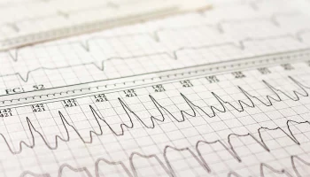 Диетолог Редина рассказала, какие продукты провоцируют развитие аритмии
