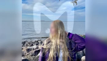 Петербурженка получила ожоги 80% тела после пятичасового лежания на солнце