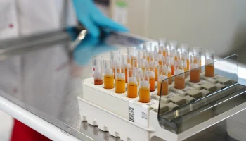 Допинг-проба российского акробата Кузьмина дала положительный результат Допинг-проба российского акробата Кузьмина дала положительный результат