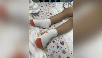 Пострадавшего в Шереметьево мальчика готовят к выходу из медикаментозного сна