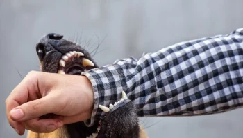 Пострадавшую от нападения собак в Николаевске-на-Амуре доставят в Хабаровск