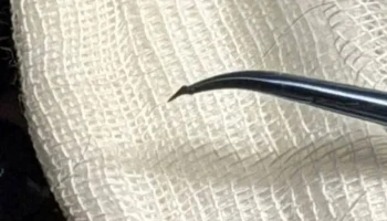 Столичные ветеринары спасли зрение собаке, в глаз которой воткнулся шип от розы